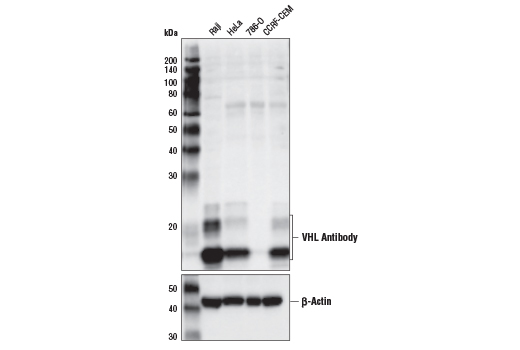 VHL Antibody