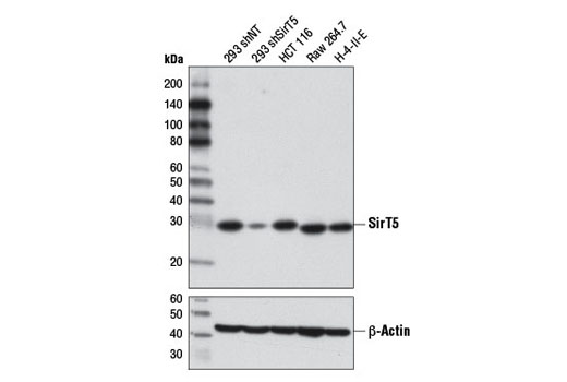 SirT5 (D8C3) Rabbit mAb