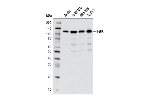FAK Antibody Sampler Kit