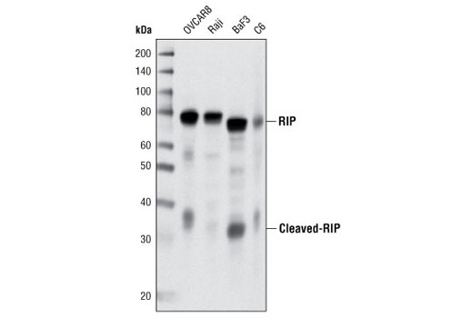 RIP (D94C12) XP Rabbit mAb