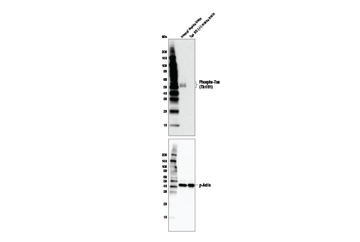 Phospho-Tau (Thr181) (D9F4G) Rabbit mAb