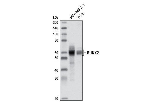 RUNX2 (D1H7) Rabbit mAb
