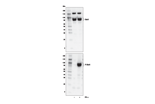 Stat1/2/3/5 Control Cell Extracts