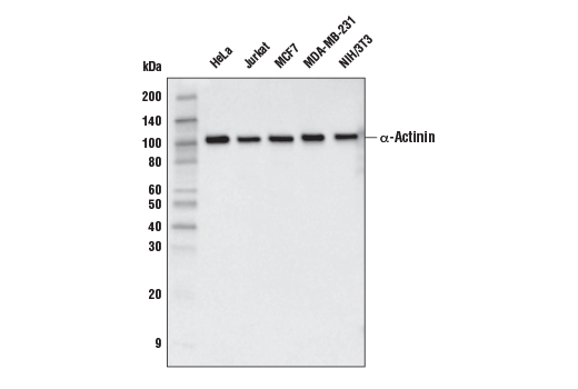 α-Actinin (E7U1O) Mouse mAb