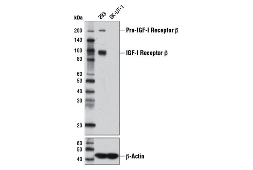 IGF-I Receptor β (D23H3) XPRabbit mAb