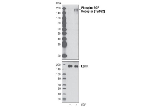 Phospho-EGF Receptor Antibody Sampler Kit