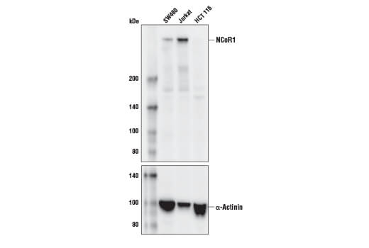 NCoR1 (E4S4N) Rabbit mAb