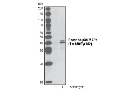 Phospho-p38 MAPK (Thr180/Tyr182) (3D7) Rabbit mAb (Biotinylated)