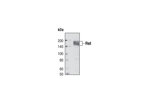 Ret (C31B4) Rabbit mAb
