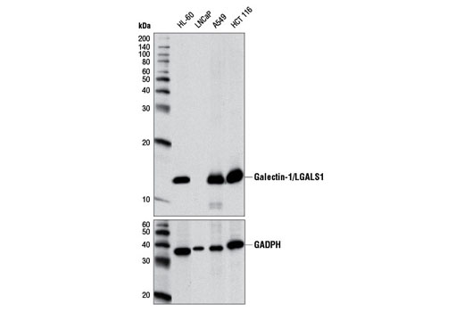 Galectin-1/LGALS1 (D608T) Rabbit mAb