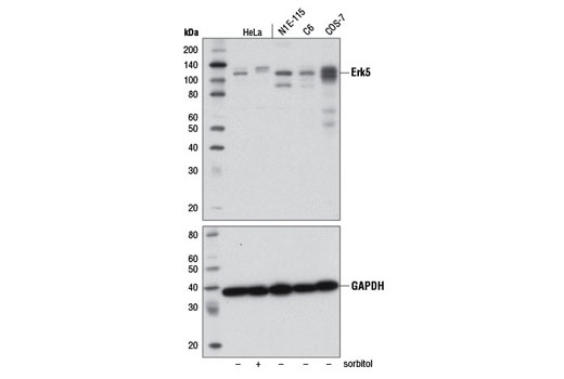 Erk5 (D3I5V) Rabbit mAb