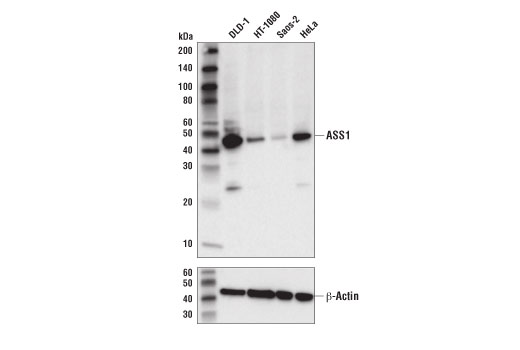 ASS1 (D4O4B) XP Rabbit mAb