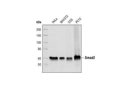 Smad2 (L16D3) Mouse mAb