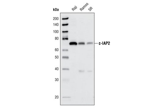 c-IAP2 (58C7) Rabbit mAb