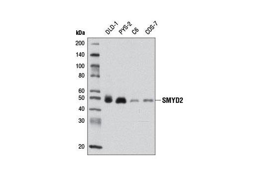 SMYD2 (D14H7) Rabbit mAb