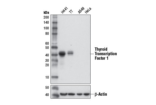 Thyroid Transcription Factor 1 (TTF-1) (D2E8) Rabbit mAb