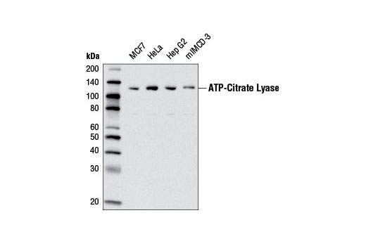ATP-Citrate Lyase (D1X6P) Rabbit mAb