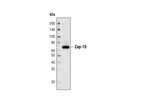 Zap-70 (D1C10E) XP Rabbit mAb