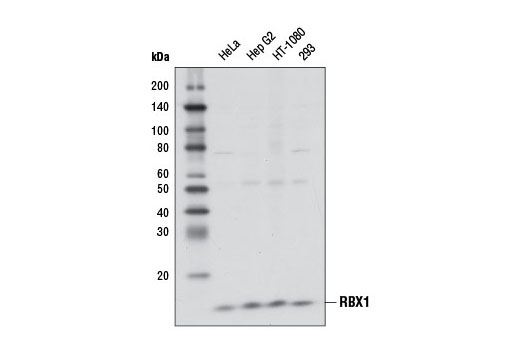 Ubiquitin E3 Ligase Complex Antibody Sampler Kit