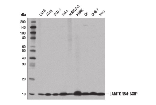 LAMTOR5/HBXIP (D4V4S) Rabbit mAb