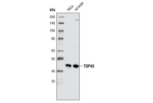 TDP43 (G400) Antibody