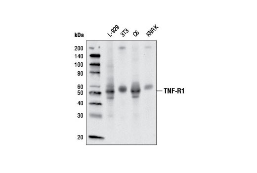 TNF-R1 (D3I7K) Rabbit mAb (Rodent Specific)