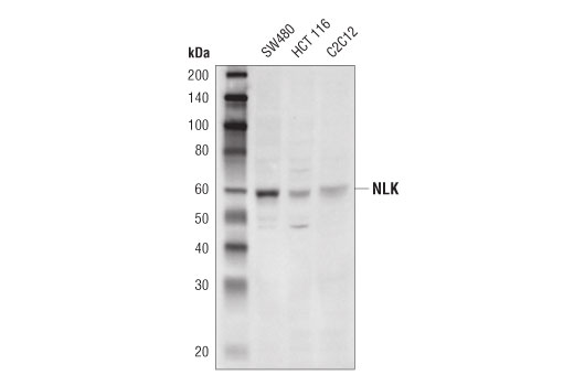 NLK (D9X3C) Rabbit mAb
