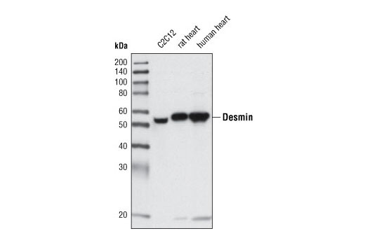 Desmin (D93F5) XP Rabbit mAb