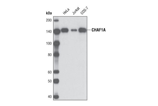 CHAF1A (D77D5) XP Rabbit mAb