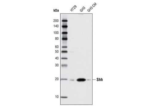 Shh (C9C5) Rabbit mAb