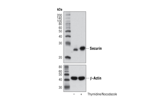 Securin (D2B6O) Rabbit mAb