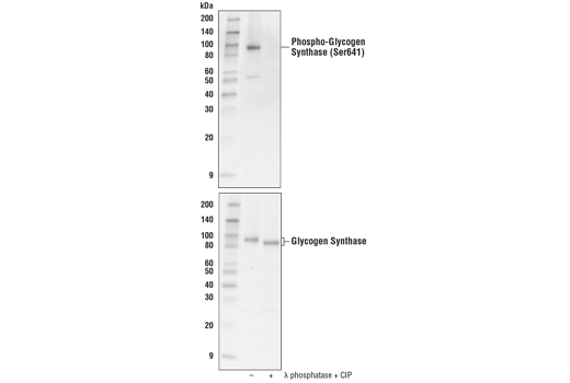 Phospho-Glycogen Synthase (Ser641) (D4H1B) XP Rabbit mAb