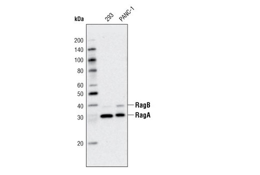 RagA (D8B5) Rabbit mAb