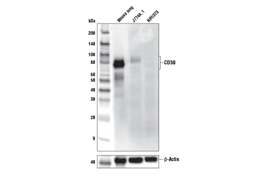 CD39/NTPDase 1 (E2X6B) XPRabbit mAb (Mouse Specific)