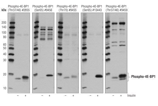 4E-BP1 Control Cell Extracts