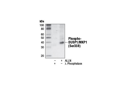 Phospho-DUSP1/MKP1 (Ser359) (125E2) Rabbit mAb