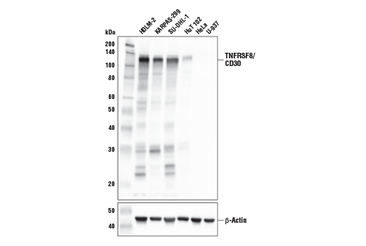 TNFRSF8/CD30 (E4L4I) XP Rabbit mAb