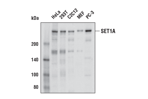 SET1A (E3E2S) Rabbit mAb