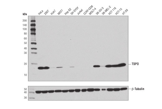 TSPO (D1N7Z) Rabbit mAb
