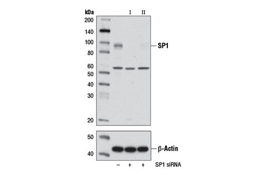 SignalSilence SP1 siRNA I