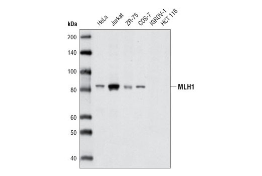 MLH1 (D38G9) Rabbit mAb