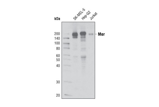 Mer (D21F11) XP Rabbit mAb