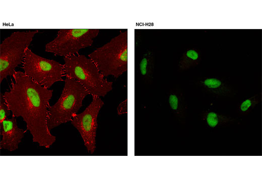 β-Catenin (L54E2) Mouse mAb (Alexa Fluor 555 Conjugate)