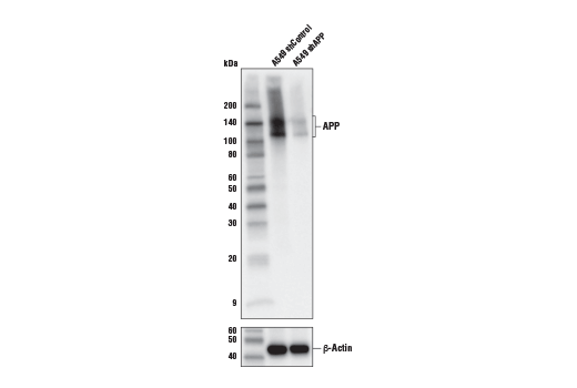 APP (E8B3O) XP Rabbit mAb