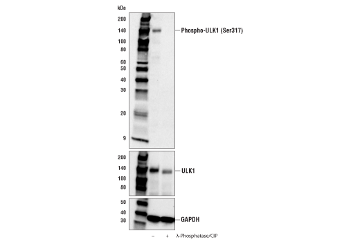 Phospho-ULK1 (Ser317) Antibody