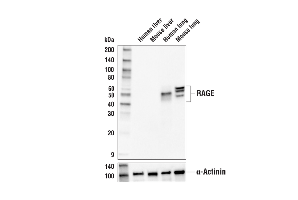 RAGE (E7I6S) Rabbit mAb