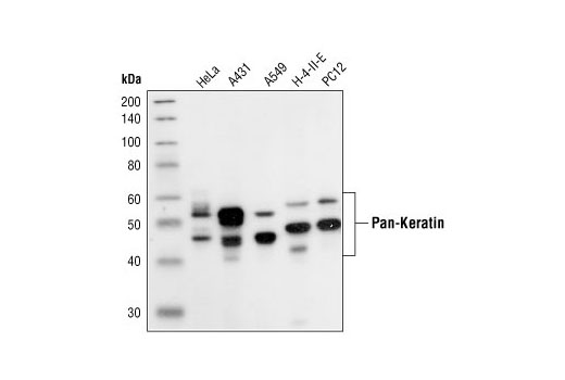 Human Immune Cell Phenotyping IHC Antibody Sampler Kit
