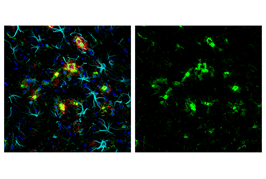 Iba1/AIF-1 (E4O4W) XP Rabbit mAb (Alexa Fluor 488 Conjugate)