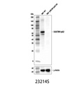 SQSTM1/p62 (D6M5X) Rabbit mAb (Rodent Specific)