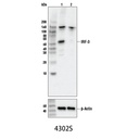 IRF-3 (D83B9) Rabbit mAb